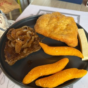 Hígado encebollado 