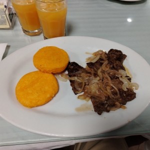 Hígado encebollado 